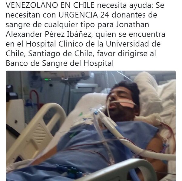 lohenareveron's tweet photo. ATENCIÓN. Jonathan Pérez Ibañez, es un venezolano solo en Chile. Está en el Hospital Clínico de la Universidad de Chile (Santiago) por una afección de "vasculitis pulmonar". Necesita con urgencia 20 donantes de sangre de cualquier tipo. #ServicioPúblico #RT #25Ene https://t.co/6h4s4Qr640