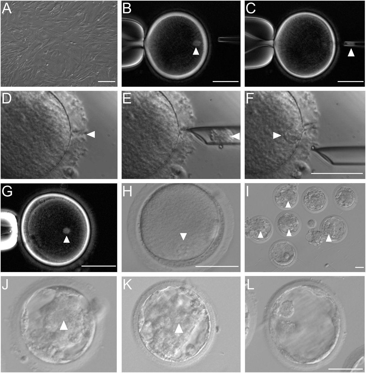 mmw_lmw's tweet photo. Cloning Macaque Monkeys | Somatic Cell #NuclearTransfer &amp; Epigenetic Modulation: Monkey Fibroblast Origin | QiangSun #CASShanghai @cellcellpress https://t.co/CqvM7rwkdm https://t.co/QKN6HtEhxz