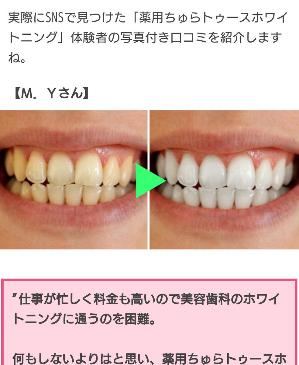 薬用 ちゅら トゥース ホワイトニング 口コミ