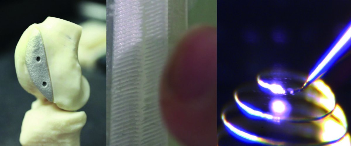 QFeslaC's tweet photo. 3 ejemplos de impresión en 3D: huesos, pelo y estructuras metálicas 
https://t.co/xAeyl5beSt https://t.co/qZcxifirFo