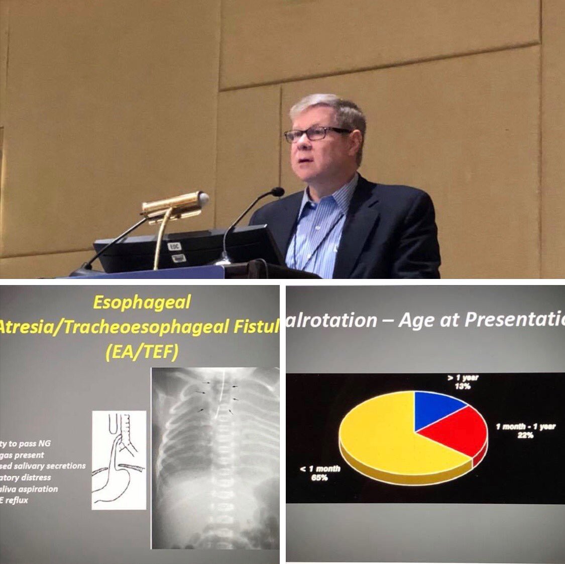 AAPneonatal's tweet photo. Dr. Brad Warner reviews developmental abnormalities of the GI tract at #NeoPrep18.  “If baby vomits green, call the surgical team.  If baby vomits yellow, call the fellow.” https://t.co/RmQbfVXtGS