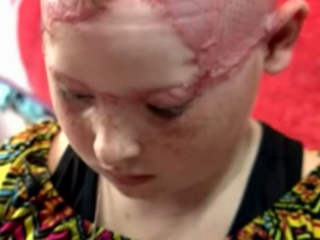 Anomen34's tweet photo. This 12-year-old was scalped before her mother's eyes| https://t.co/WTofwSPeMc by #mulplayer via @ridder_co https://t.co/Q8J5ZyW065