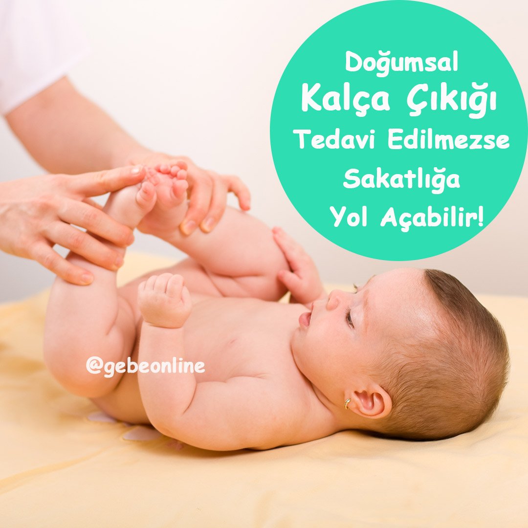 Doğumsal Kalça Çıkığı Tedavi Edilmezse Sakatlığa Yol Açabilir!