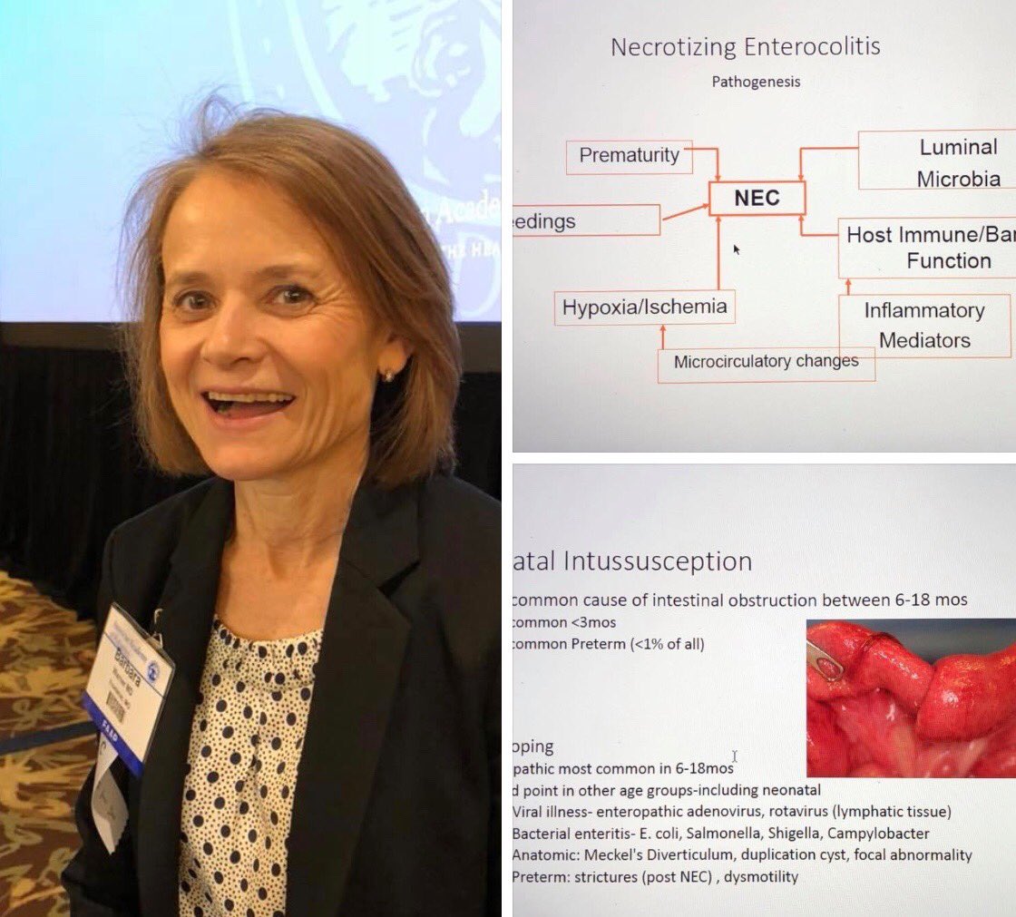 AAPneonatal's tweet photo. Barbara Warner reviews acquired disorders of the GI tract on our last day of #NeoPREP18 https://t.co/RD6OXgd9lM