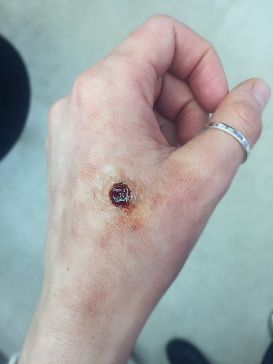 Practice makes perfect. #bts #supernatural #spnfamily #bulletwound #makeupfx #makeupartist #practice