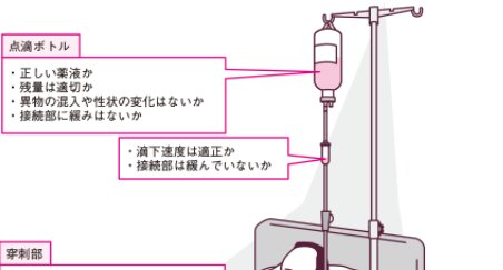 ট ইট র 5年目ナース応援 看護roo 点滴静脈内注射が血管外に漏れるとどうなるの 点滴静脈内注射が漏れると 腫脹が起こり 浮腫が全体に広がります そんなときどうしたらいいの ﾟdﾟ 正しい処置とポイントをお教えします T Co