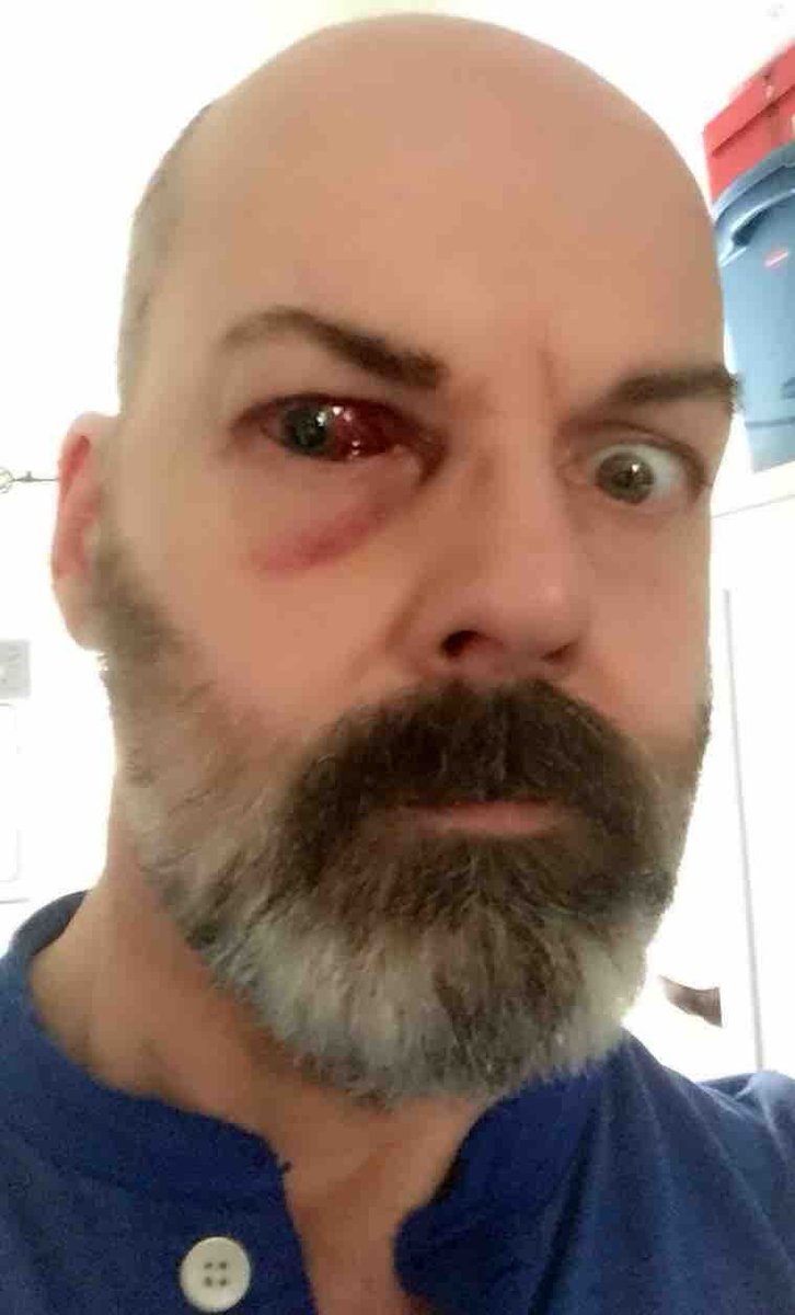 atlantistvru's tweet photo. Let's help #Stargate #SG1 #actor #KevinBlatch (@Kevin_Blatch) to get new one surgical operation & recover.
https://t.co/qd6PvBgdoJ
#StargateSG1 #GoFundMe https://t.co/0jz4ArJePL