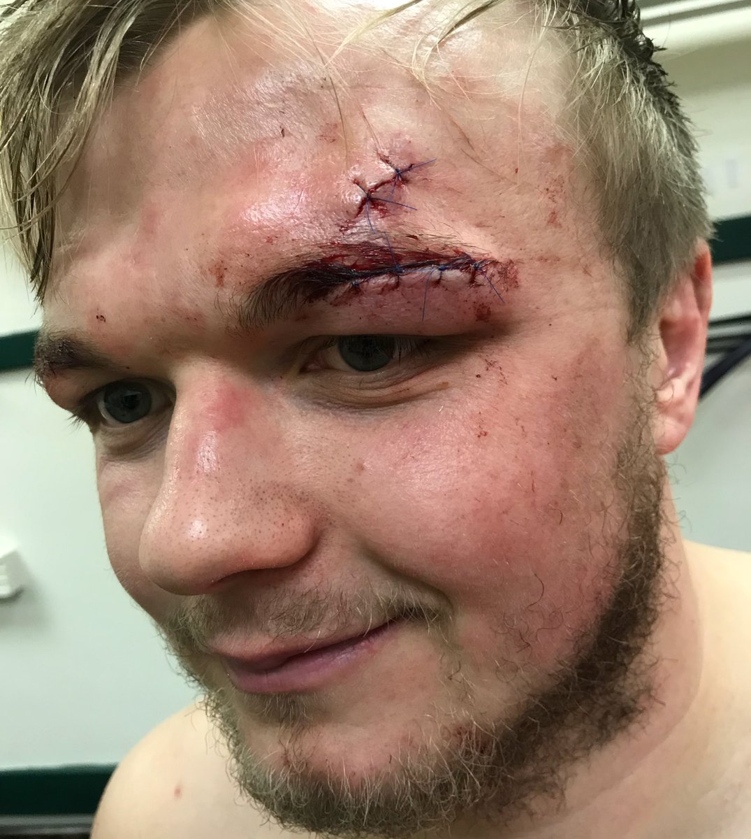 LeicesterTigers tweet picture