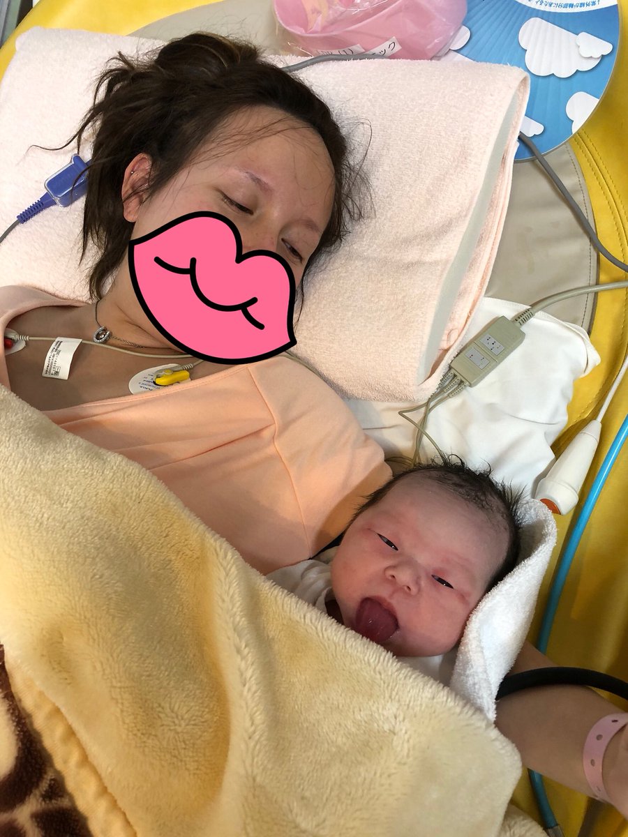 xeww1's tweet photo. 🗣出産報告🗣

🗓 : 2018 / 1 / 28
⏰ : AM 10 : 33
⚖️ : 3072 g
🚻 : 女の子

予定日を大幅に１週間過ぎ、
30時間越えの陣痛に耐えて生まれて来てくれました。

葛西 遼香(りょうか)です👶🏻🎀

側に居続けてくれた一希君、
なにより五体満足で出てきてくれた遼香。

ママにしてくれてありがとう。 https://t.co/KGk3DjyObE
