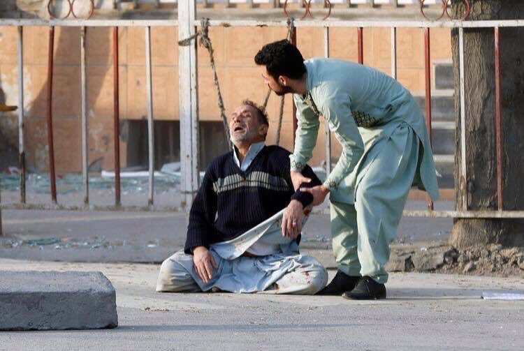 Teymour_Ashkan's tweet photo. Nearly 200 killed in a bomb blast in Afghanistan. Nearly everyday there is an attack. https://t.co/fNQLL4bHiZ