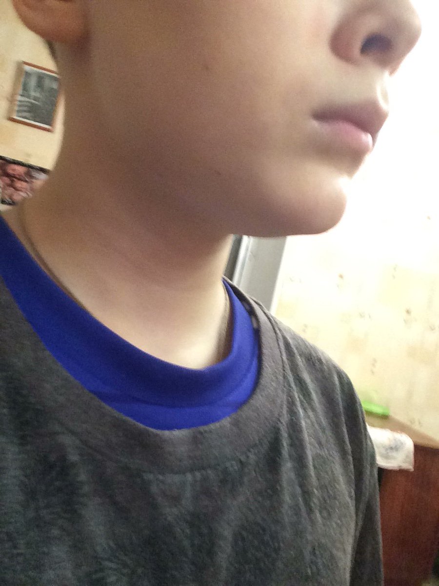 vAnYA7755556's tweet photo. Вроде нормальное фотоа че мои друзья все так фотографируются||||||
It seems to be normal photos my friends are all so photographed https://t.co/5R3cTa1hs1
