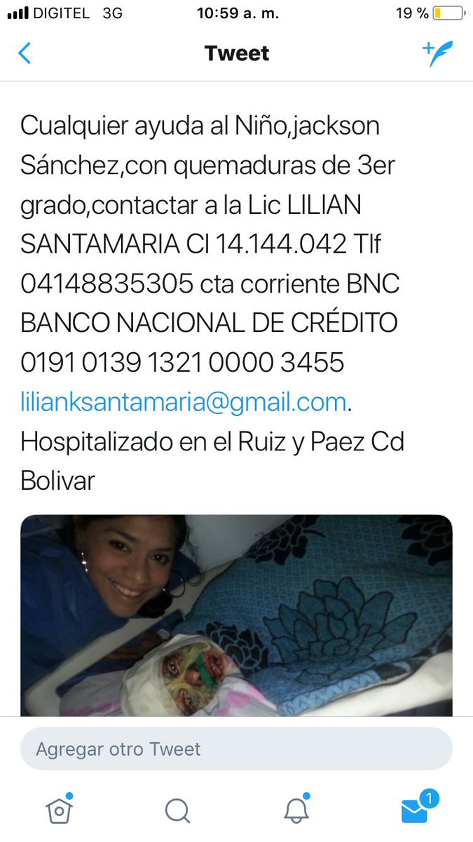 Jackson Sanchez(9) sufrió quemaduras de 3er grado.Cuando el rancho en el que vivía,en Los Culies,San Félix,Bolivar;fue incendiado por manos criminales.Fue asistido por la hermana Carmen,moja del sector.Está recluido en el Hospital Ruiz y Paez en Cd Bolivar.S.O.S