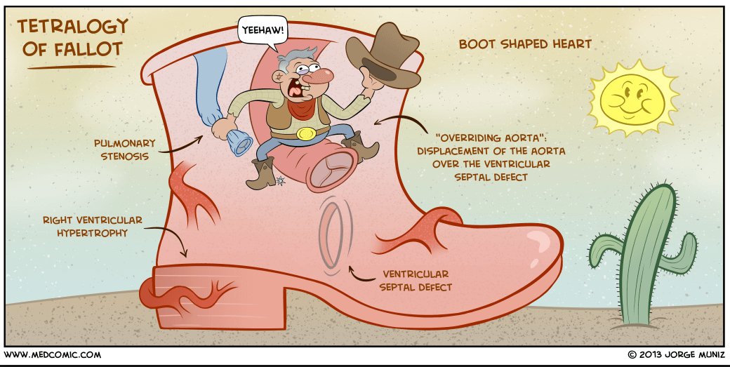 Med432's tweet photo. tetralogy of fallout #Med432 https://t.co/hhQMvtfbEv