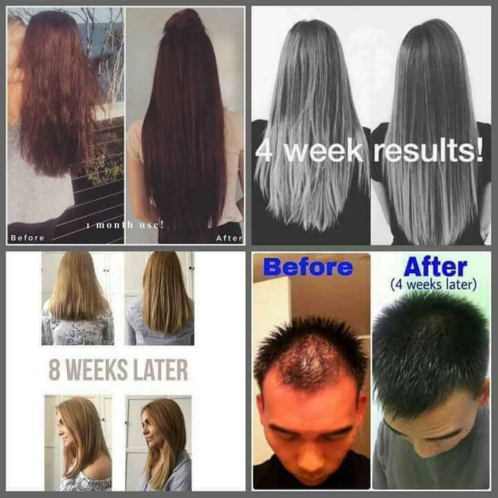 Aatifas Pantry On Twitter Hairfall Shampoo That Actually Works