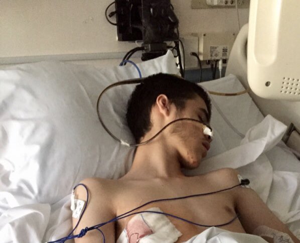 harrispetaluma's tweet photo. Please support Christopher Hopkins, a #Petaluma resident, in his recovery. Here is his GoFundMe campaign: https://t.co/eAEMXM2pVL Check out the original article at: https://t.co/y0seExxobk #SoSenseless https://t.co/02Vslk54En