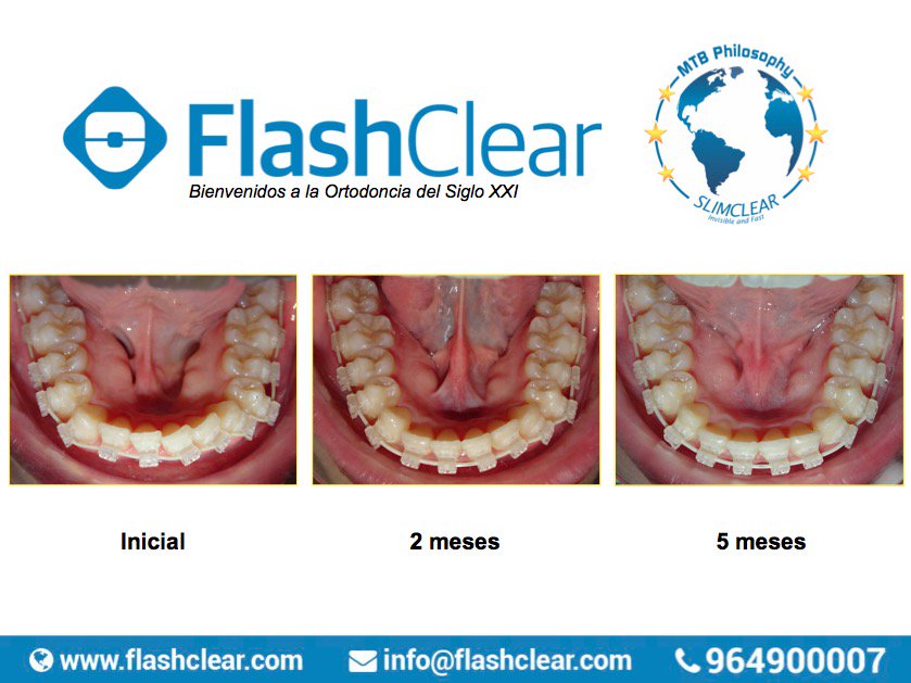 FlashClearSys tweet picture