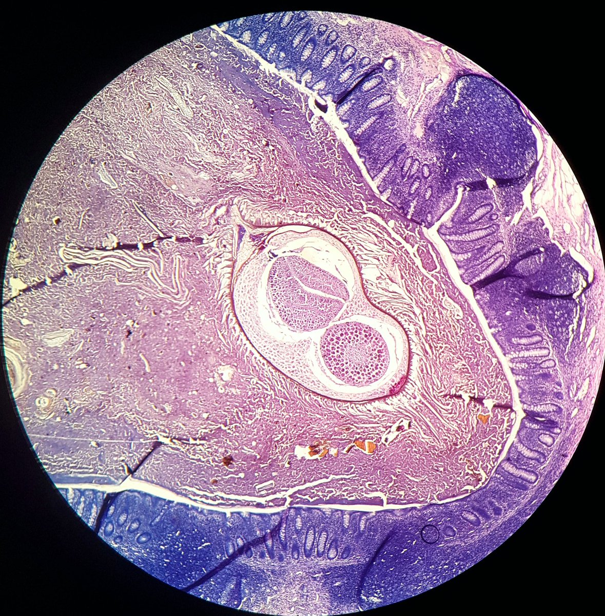 appendix histology