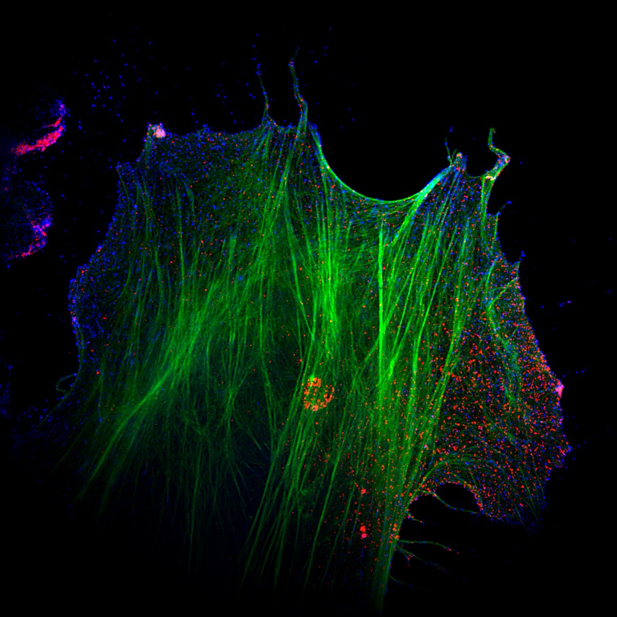 Snusmumrik_K's tweet photo. #image_competition #TIRFSIM Our image got the shared 1st prize in NDORMS Imaging Symposium! https://t.co/w55A5OGJL5