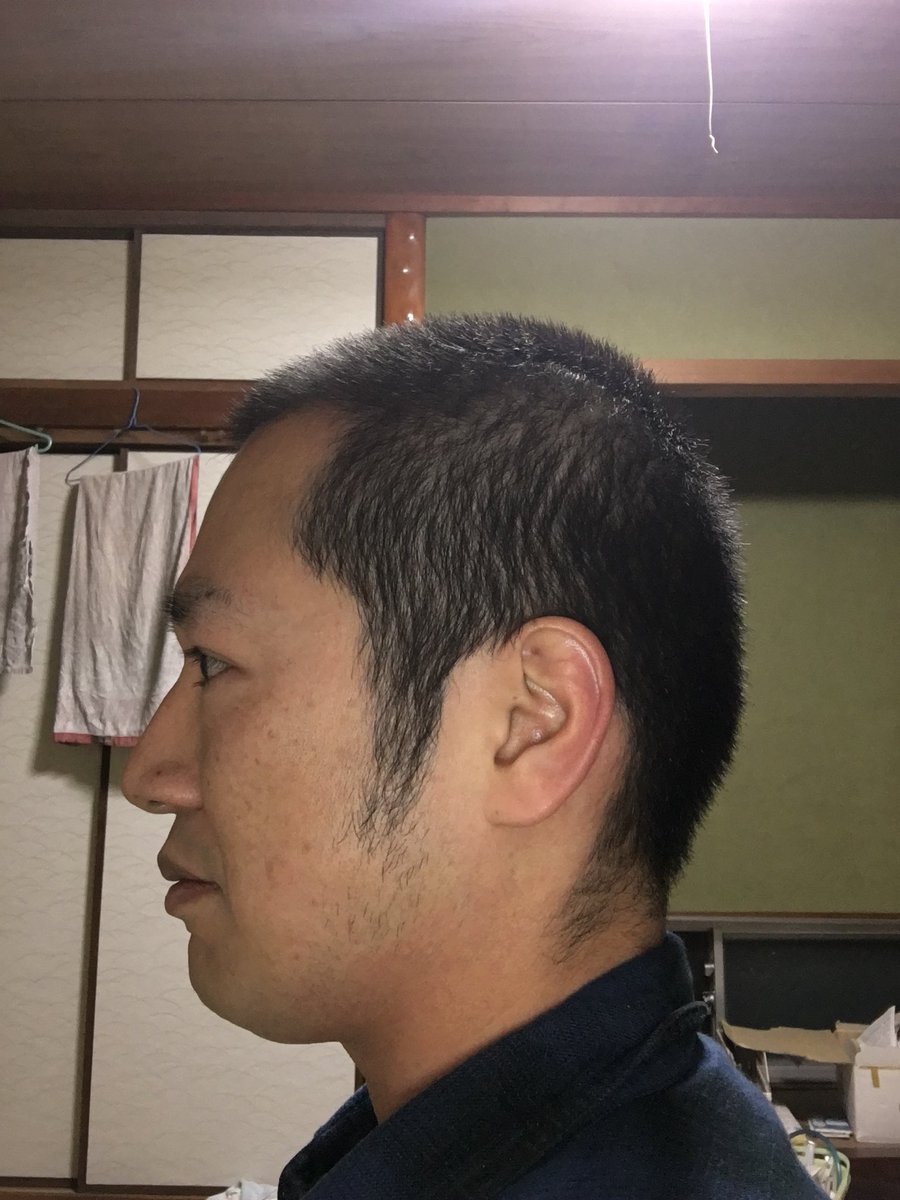 髪の毛成長記録