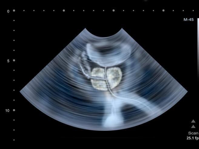 SanRaffaeleMI's tweet photo. Dieta e prevenzione dell'#ipertrofia #prostatica - i consigli del prof. Montorsi via @Corriere_Salute https://t.co/UsefEwI3AL https://t.co/i2ClaKMwXf