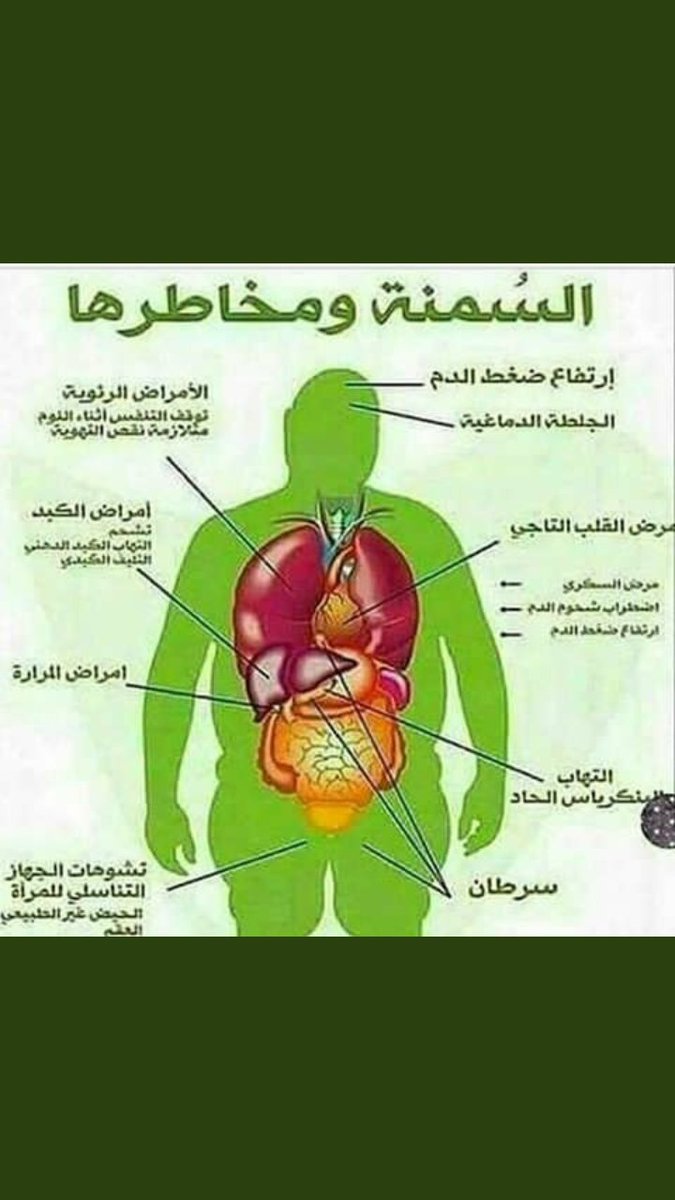 mandobtasweq's tweet image. مخاطر السمنة 😟