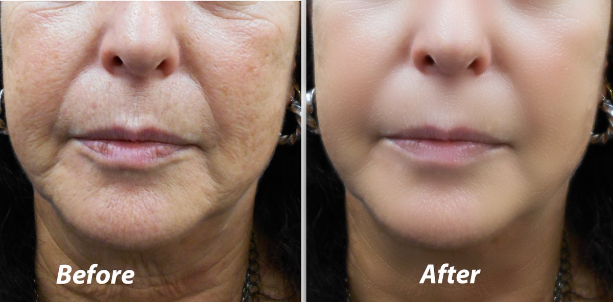 expert_bd's tweet image. @expert_bd