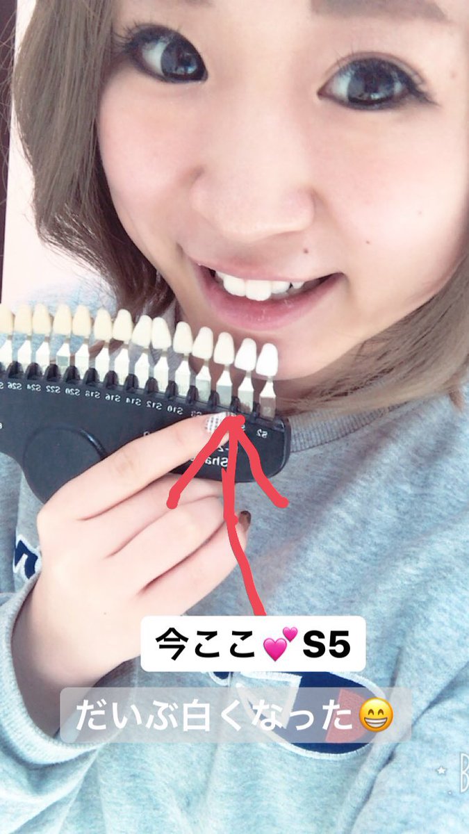 いくみん 韓国の鈴木奈々 Di Twitter まじで歯が白くなってきた あともう少しで最強の白さになれる いくみん 韓国の鈴木奈々 Di Twitter まじで歯が白くなってきた あともう少しで最強の白さになれる
