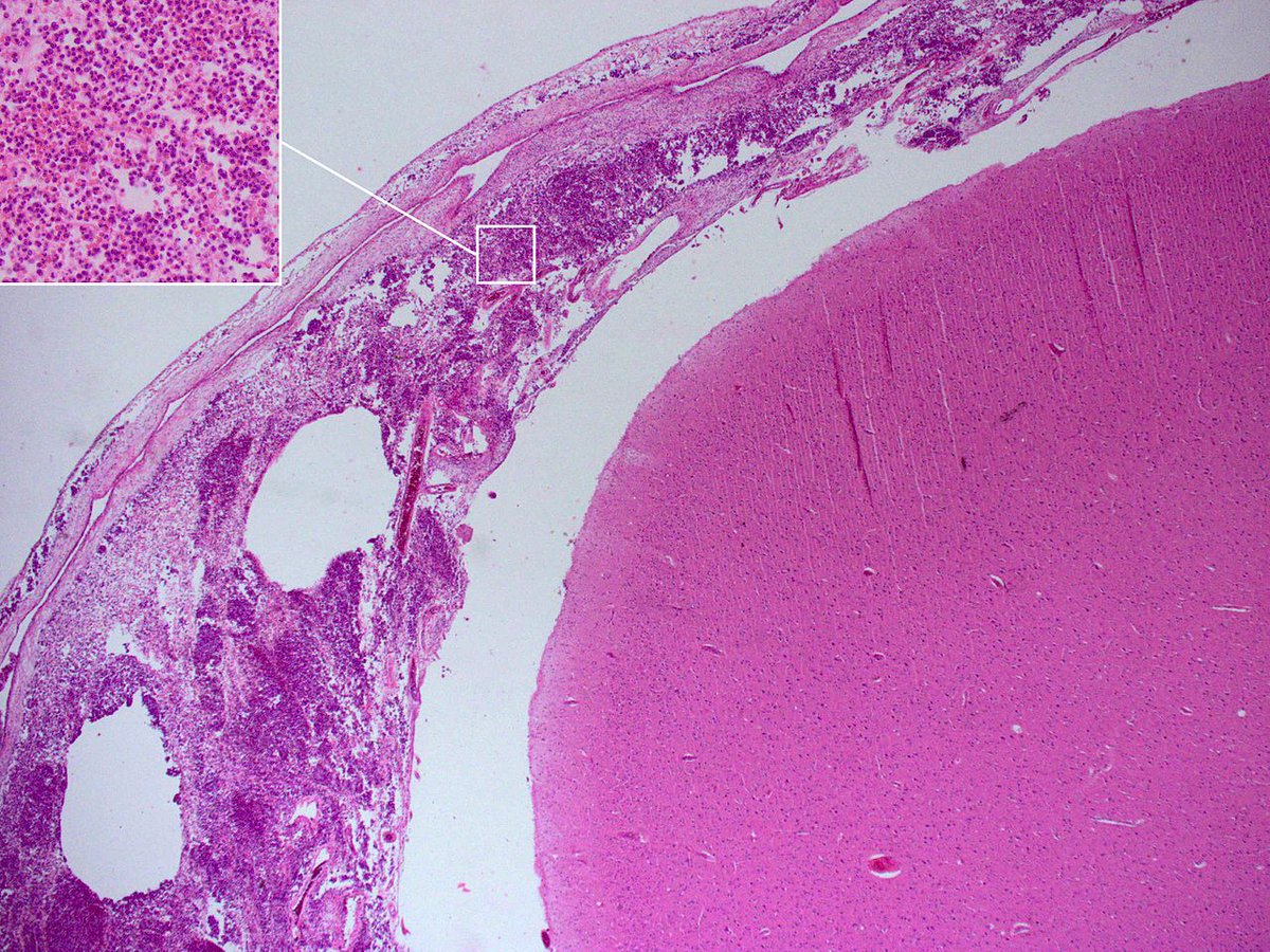 read dynamic surface tensiometry in medicine