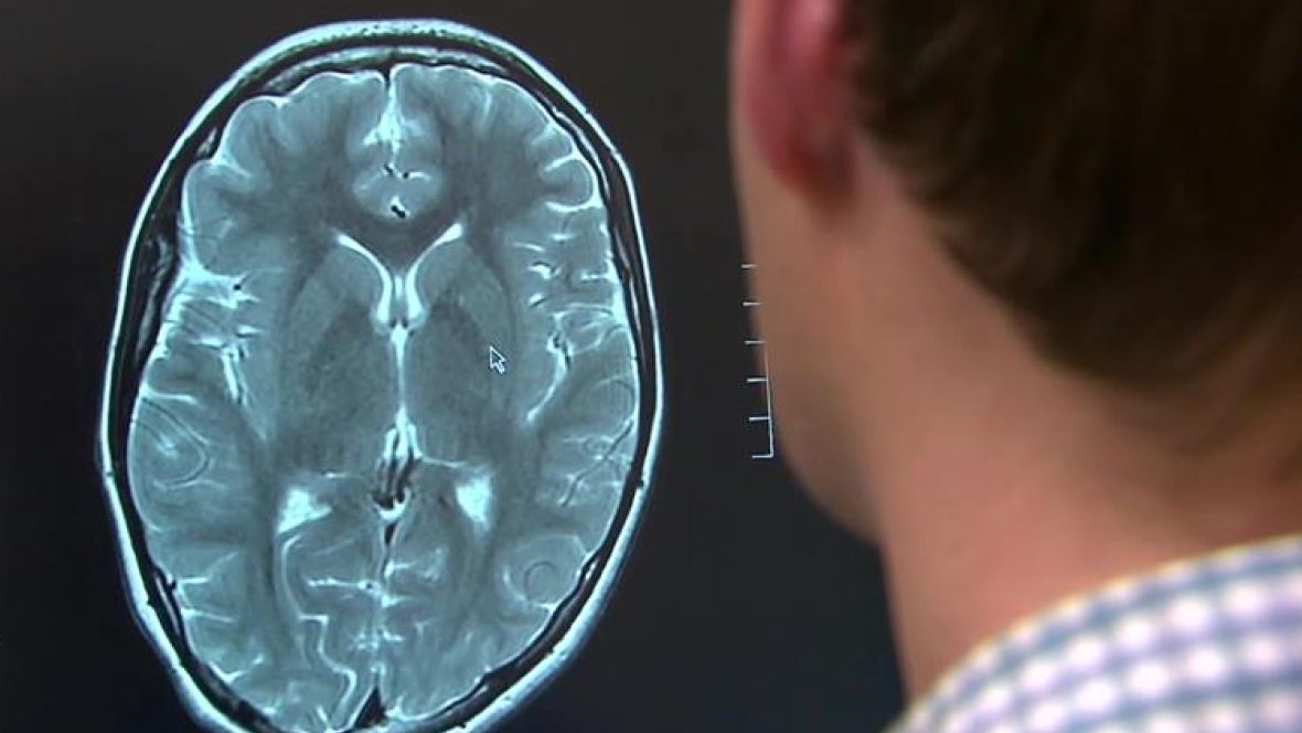 #ConcussionNews | <a href="/UBC/">University of British Columbia</a> study finds extended rest isn't best for teenagers with #concussion <a href="/DMCBrainHealth/">Djavad Mowafaghian Centre for Brain Health</a> @UBCmedicine 

buff.ly/2EkVGFt