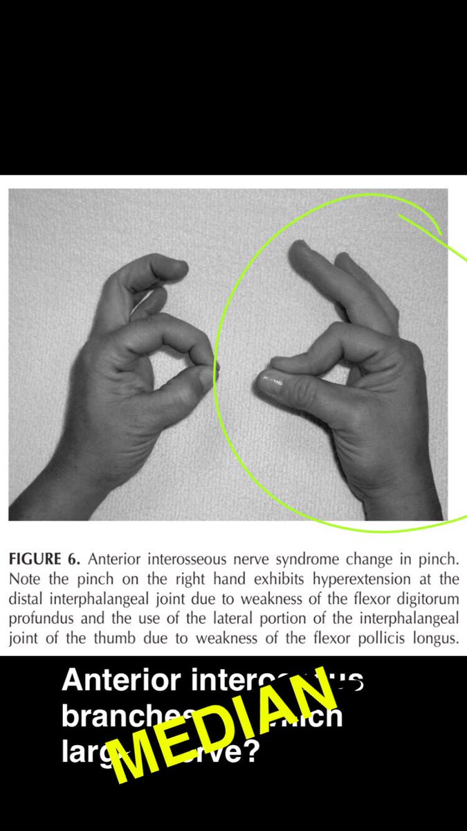 SnapSPT 👻 tweet media