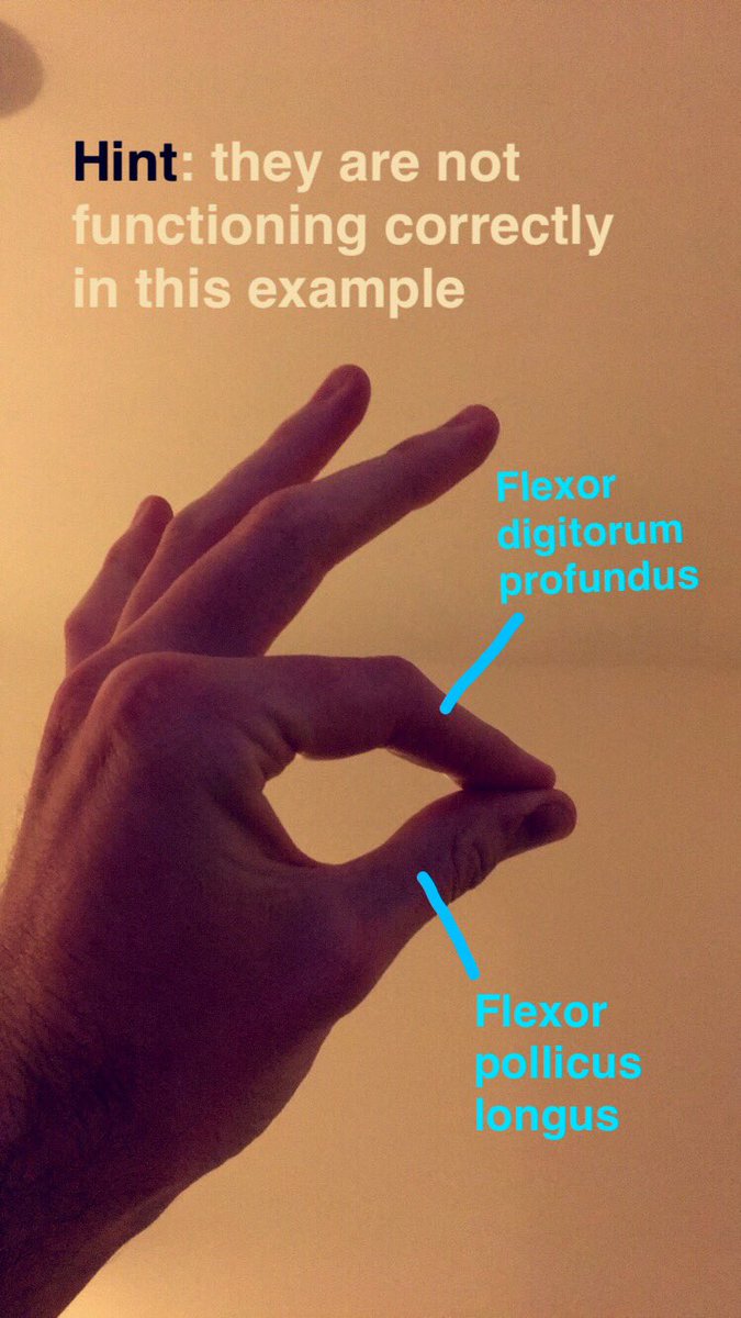 SnapSPT 👻 tweet media