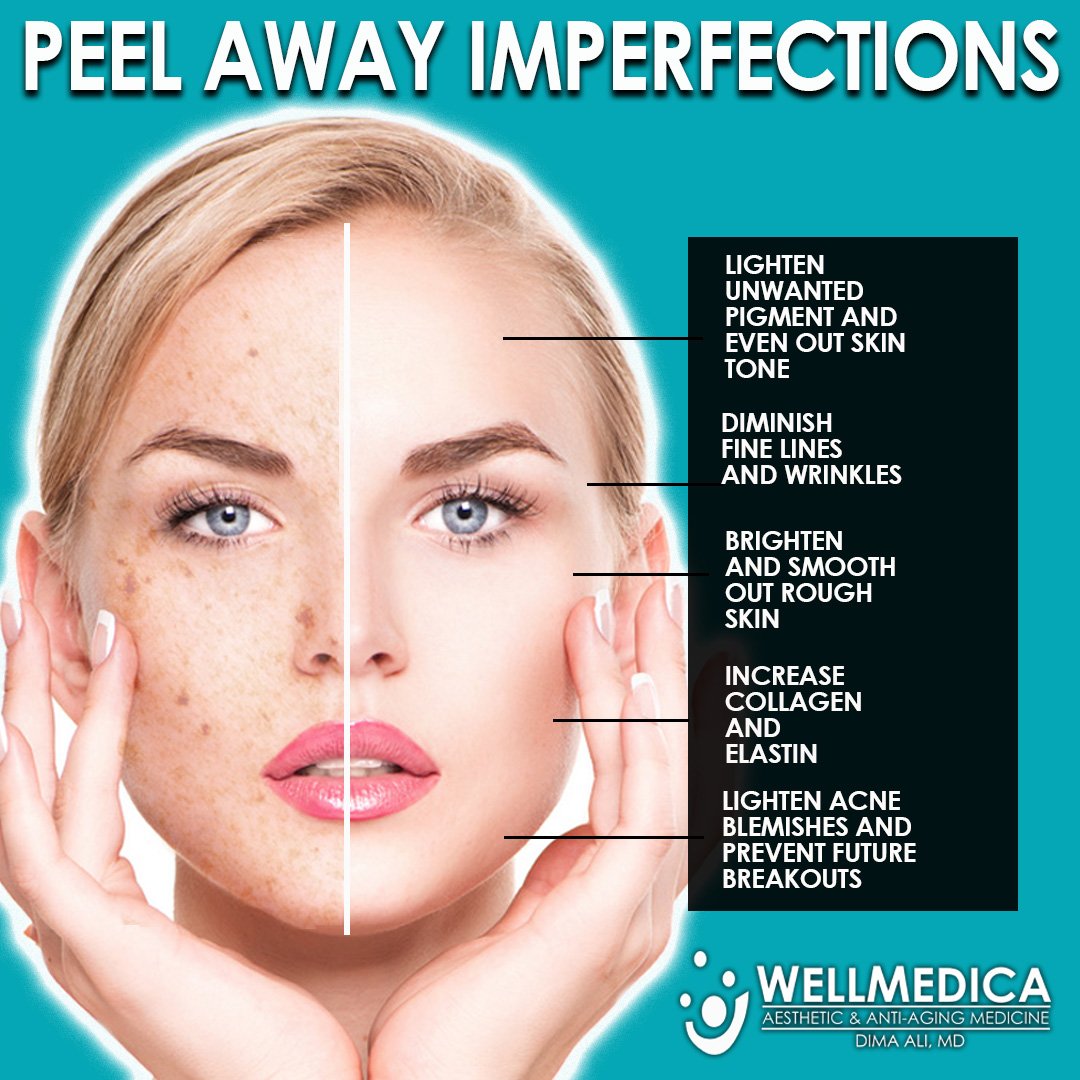 WellMedica's tweet photo. You can now receive a #ChemicalPeel on your lunch break, and go back to work right after looking even better than before!

To learn more about Chemical Peels at WellMedica click here: https://t.co/SzF1uVwRzr

#WellMedica #DrDima #Skincare #Reston #Tysons #DC #Beauty #MedSpa https://t.co/kTg1LEhRCG
