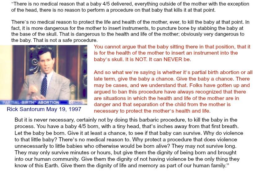patriotmom61's tweet photo. #Abortion lies exposed. Thank you @RickSantorum. It is NEVER medically necessary, EVER, to kill a baby to save the health or life of the mother. NEVER. #PainCapable #20WeekBan #TheyFeelPain #Democrats #ProLife #tcot #MAGA #ItsABaby #TuesdayThoughts https://t.co/GiGCX256Wv