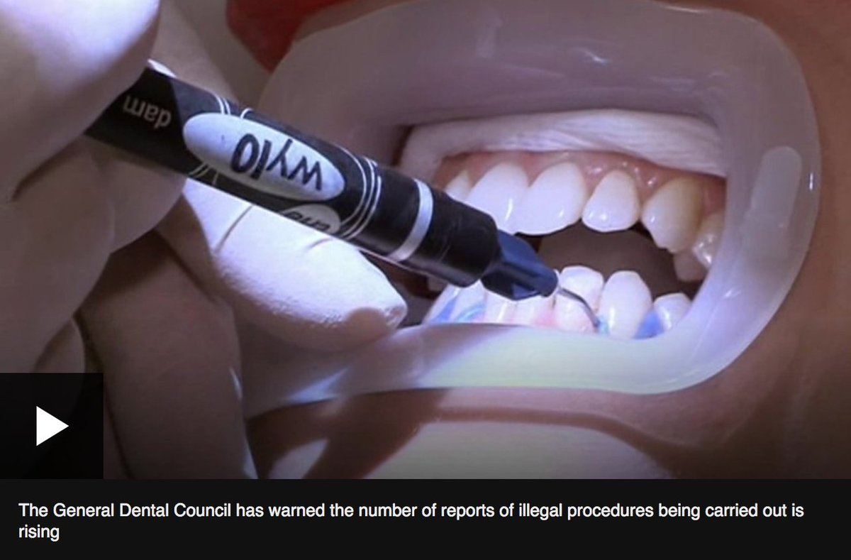 TobyTalbot's tweet photo. BBC news has reported that they have found instances of #illegal #teethwhitening in London leaving #patients in 'excruciating' pain. https://t.co/86tcdCuZ17 https://t.co/ZPYXdi9Lmv