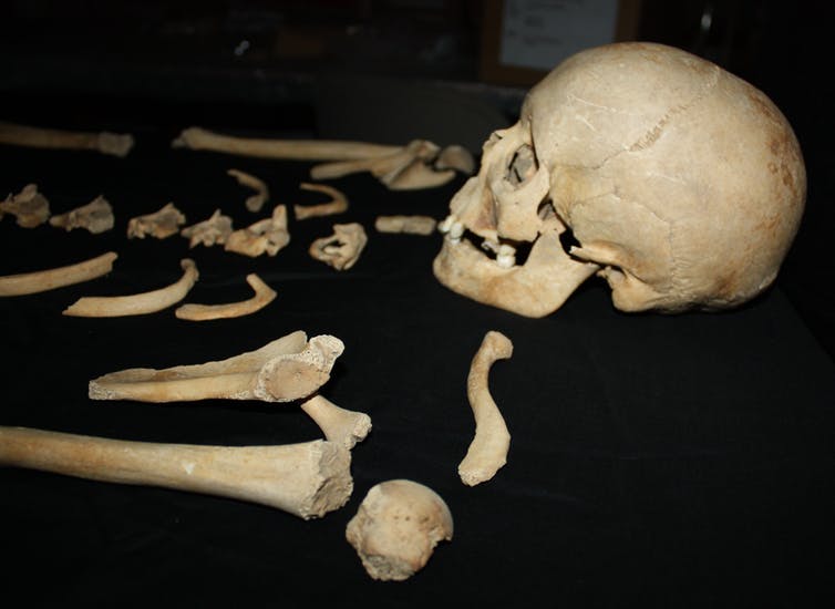 johnhawks's tweet image. Not the last word but an important historical corrective: "Children aren’t starting puberty younger, medieval skeletons reveal" theconversation.com/children-arent…