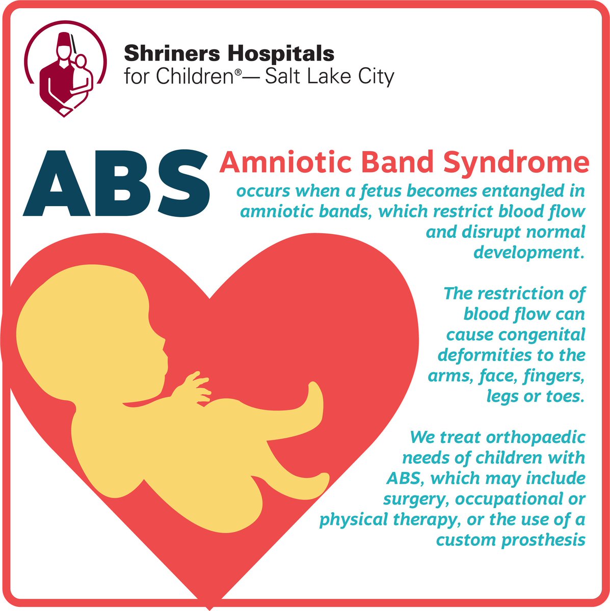 #amnioticbandsyndrome is a rare condition, but doesn't have to be frightening. We see kids thriving everyday! #shrinershospitalSLC #ABS