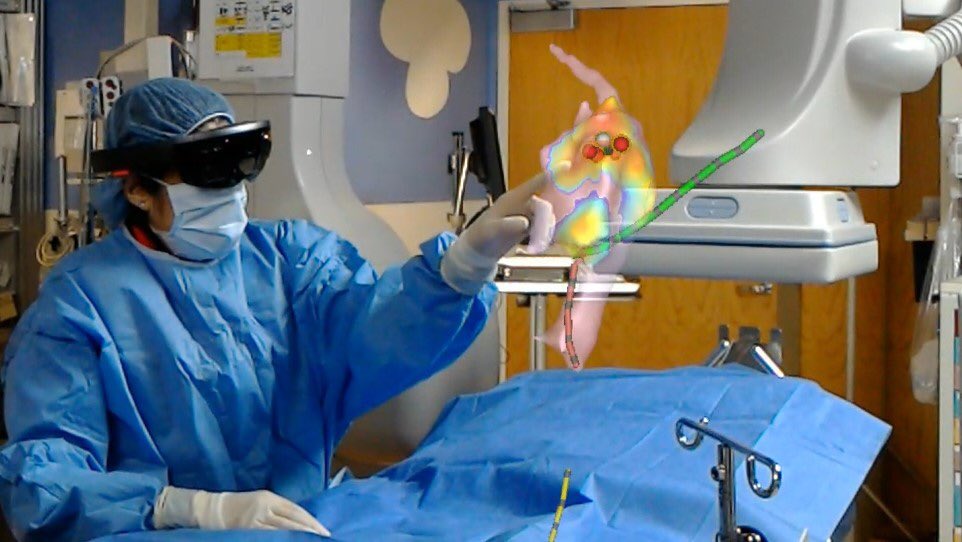 BioGeneratorSTL's tweet image. .@sentiarco lands $2.2M federal grant to advance augmented reality cardiac hologram research: biogenerator.org/wp-content/upl… #stl #AR