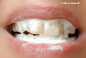 jodanelle's tweet photo. Dents blanches quelques astuces
et mon expérience avec 3 dentifrices @LOGONA_Natur @Pachamamai_soap et @artistesdenature
https://t.co/F8tNWNSoZL
#dents #teethe #toothpaste #dentifrice #naturel #natural #hygiene #astuces #tricks https://t.co/OoWlILDnpN