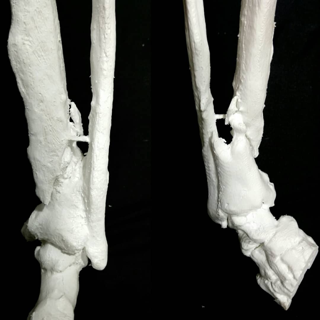 MM3D_'s tweet photo. #medicalmodel3d #fracturadetibia para estudio #preoperatorio. #3DPrinting #medicaldevice #cirujia #traumatologia #impresion3d #mm3d_ #tibia https://t.co/FfXf3rWsd8