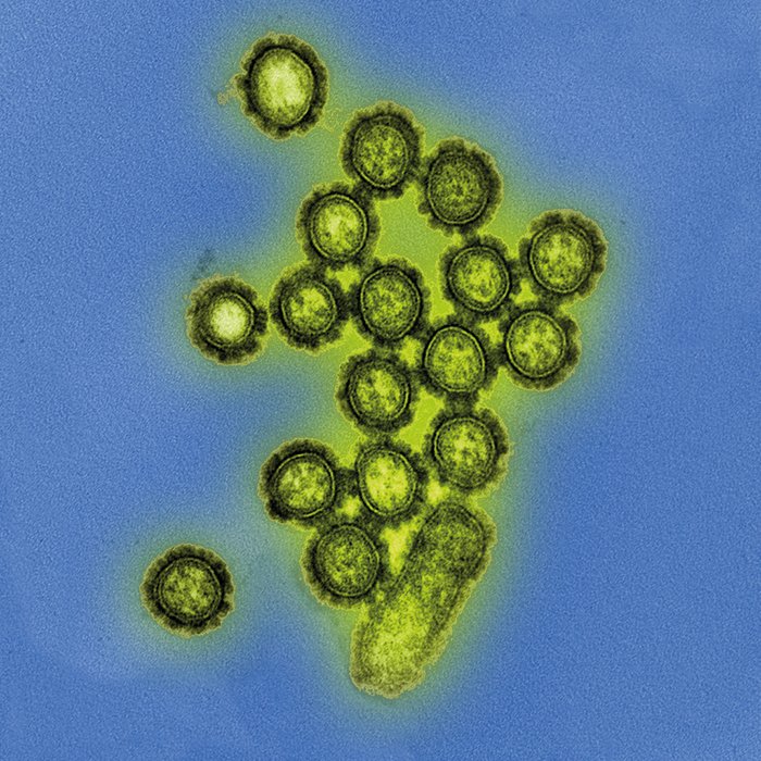 humanityaward's tweet photo. How close is the pharmaceutical industry from creating a universal vaccine? https://t.co/TduGZyZW7g https://t.co/gTbgpzK3tB