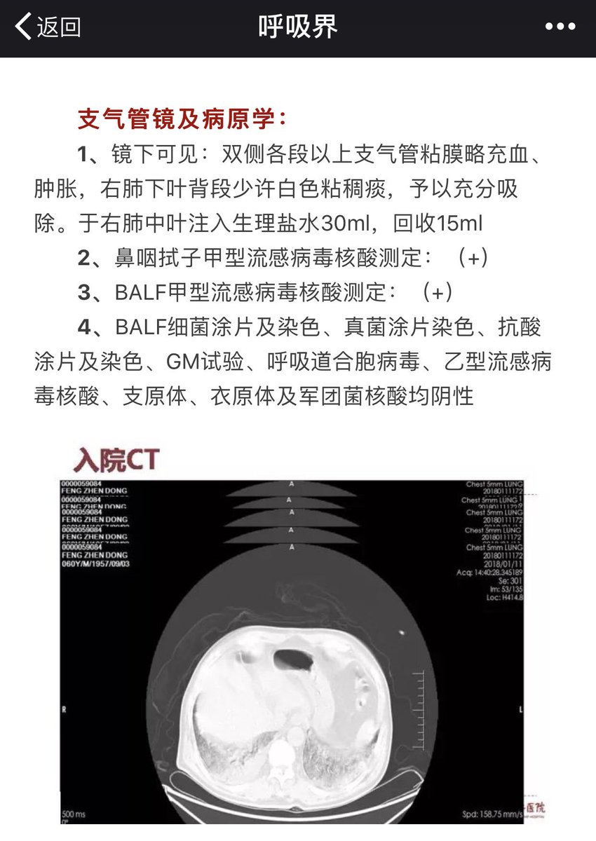 我的日志 Xys 18 2 28 1 Attachment