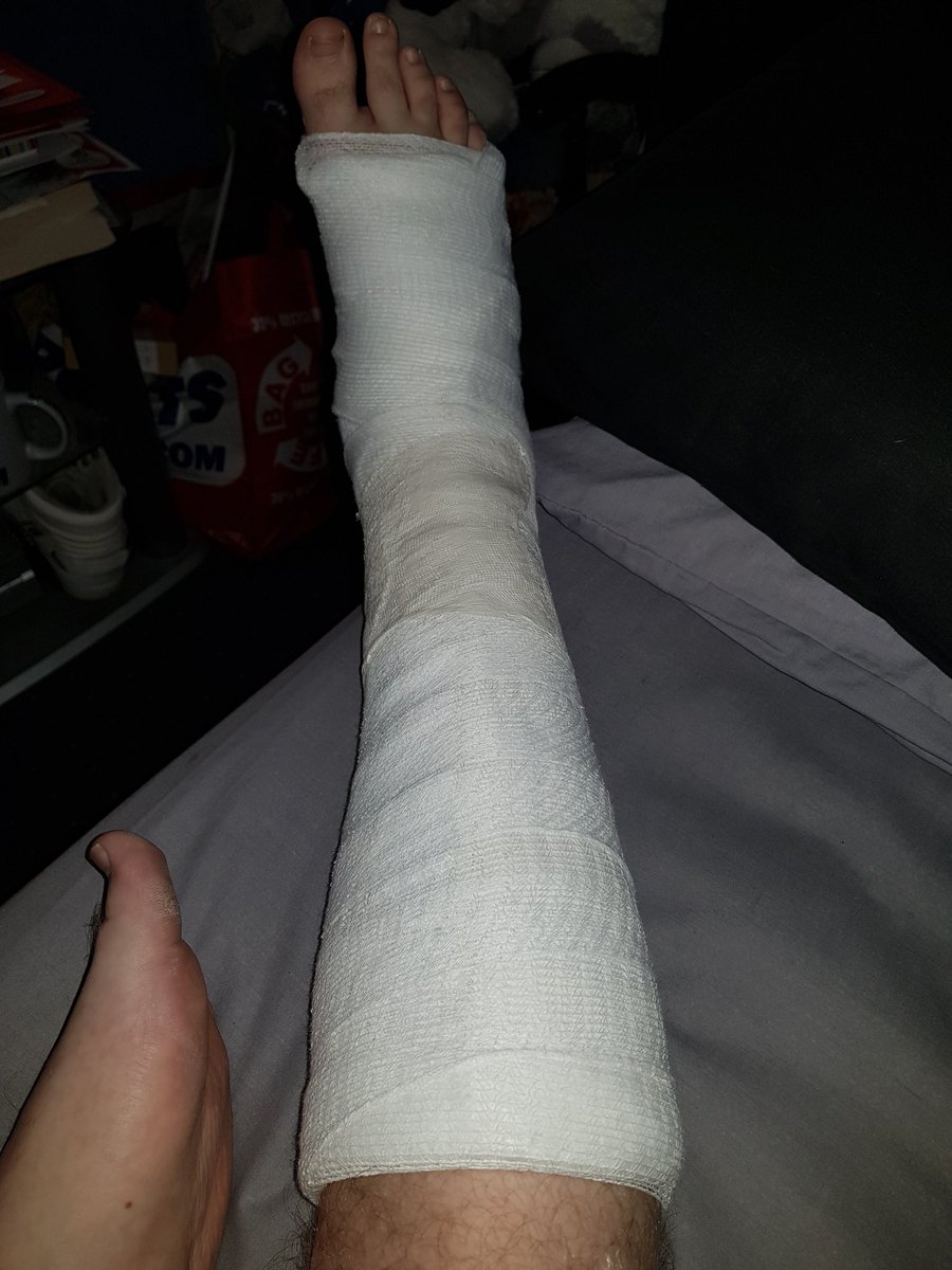 sam_birdsall's tweet photo. broke the 5MT , so back to the hossy tomoz 😷😷 https://t.co/4ulKNXhqb1