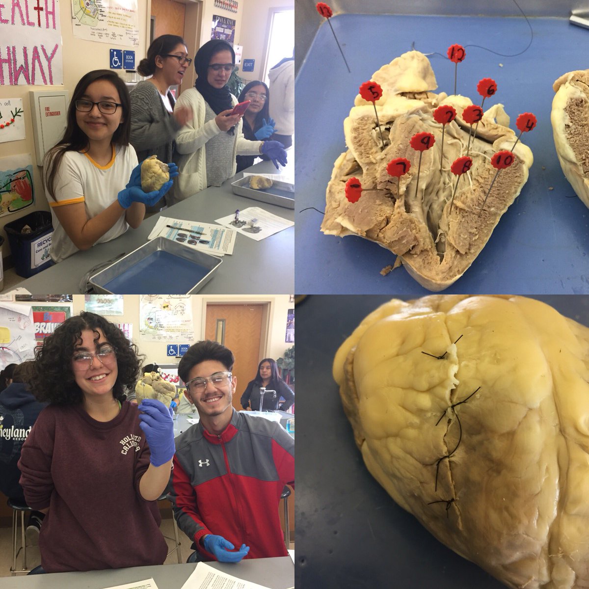 smithecvhs's tweet photo. Heart surgery, stitches, and anatomy labeling for Health Pathway students at ECV. ❤️❤️#ecvscience https://t.co/8CDtA5ALxU