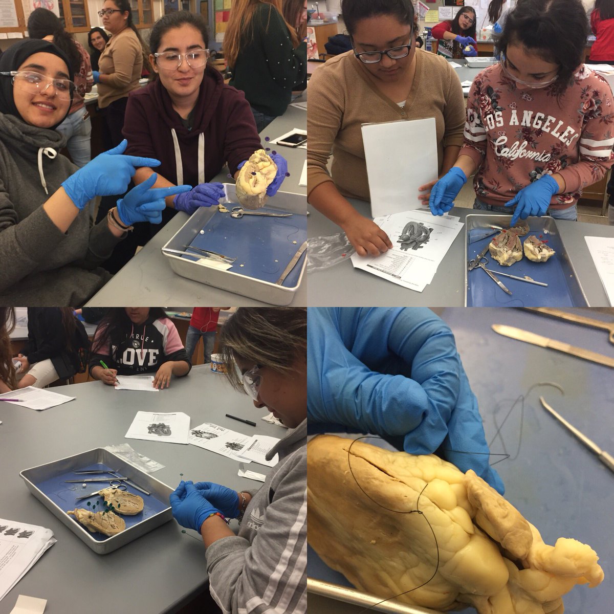 Heart surgery, stitches, and anatomy labeling for Health Pathway students at ECV. ❤️❤️#ecvscience