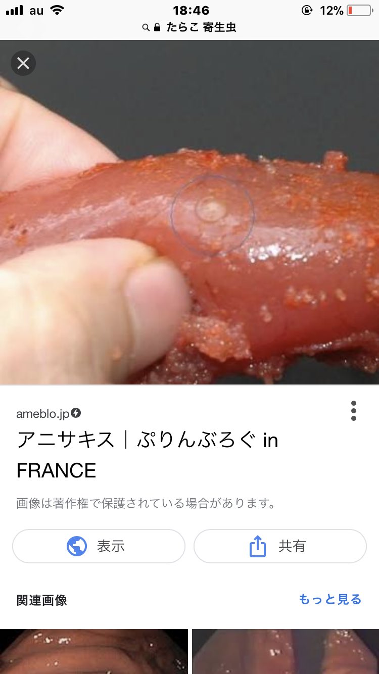 Naaco 4y 2y みんな アニサキスが出たよ しかも たらこからだよ 魚だけじゃないよ あたし 知らなかったよ みんな気をつけて 気持ち悪くて食欲失せたよ アニサキス 拡散 T Co 5r5sv5ztao Twitter