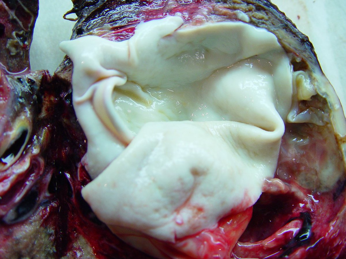 BellaMicheleang's tweet photo. lung: hydatidosis echinococcus cysts https://t.co/for2thj0Bf