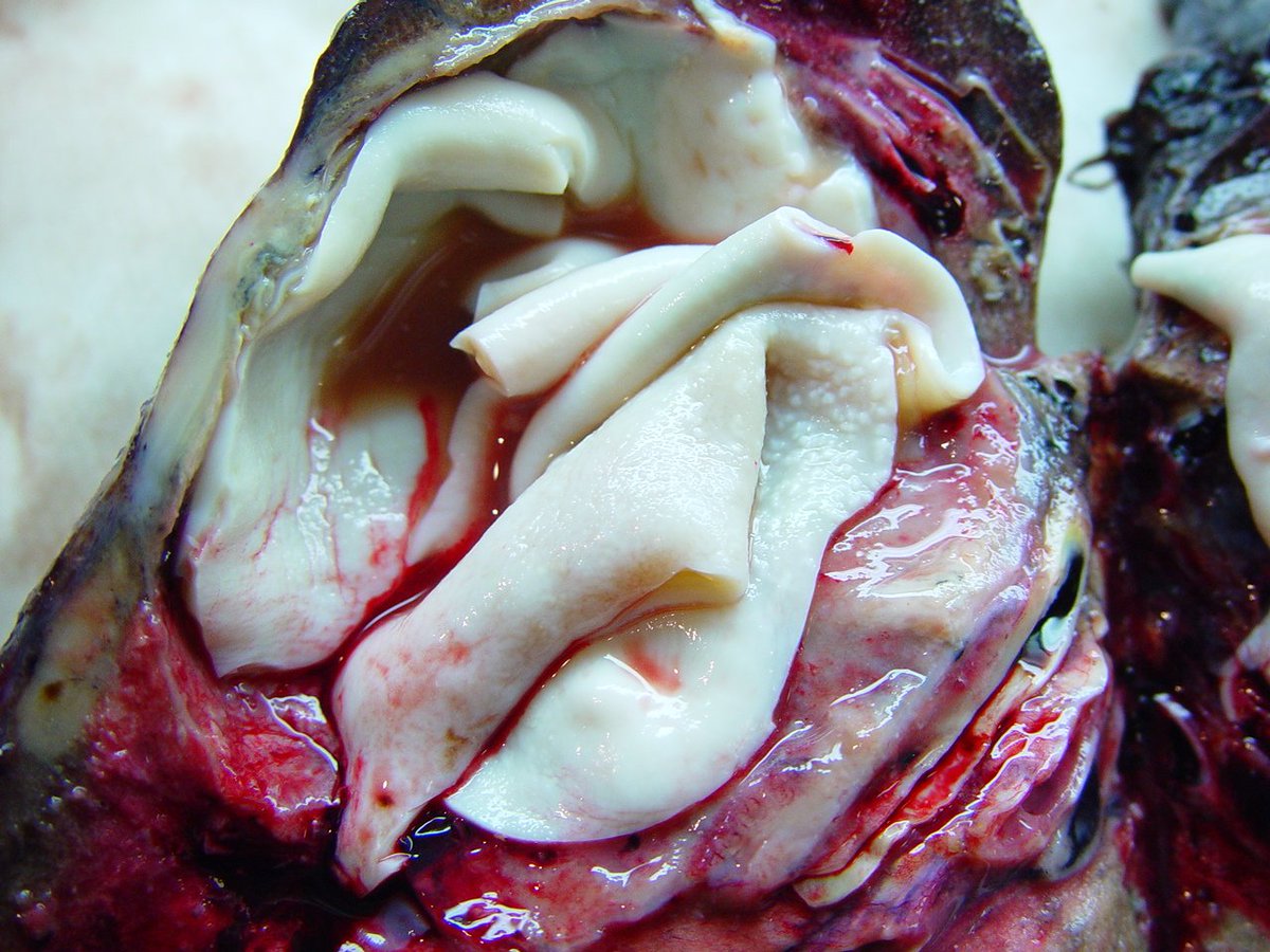 BellaMicheleang's tweet photo. lung: hydatidosis echinococcus cysts https://t.co/for2thj0Bf