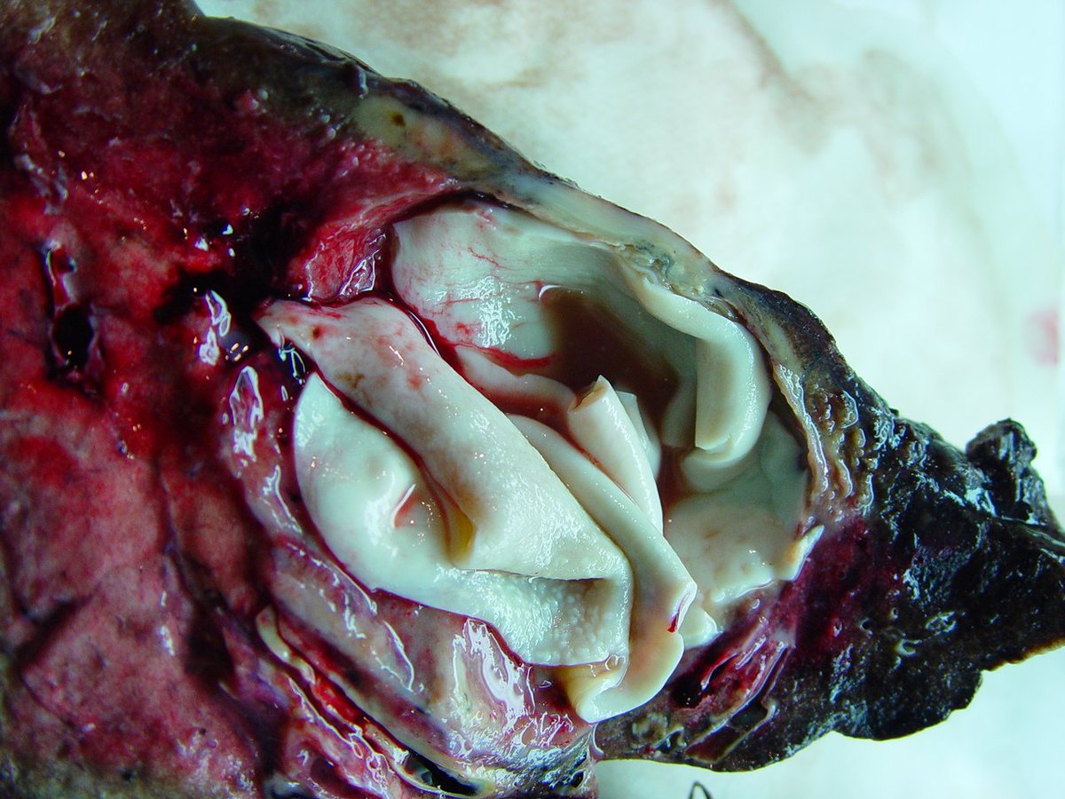 BellaMicheleang's tweet photo. lung: hydatidosis echinococcus cysts https://t.co/for2thj0Bf