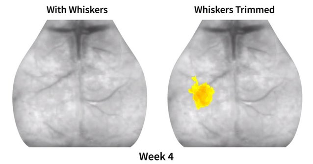 RFurnish's tweet photo. Latest research in #stroke recovery makes big steps toward #treatment solutions. https://t.co/4YVxRuw8eh https://t.co/FXEB7FMkFg