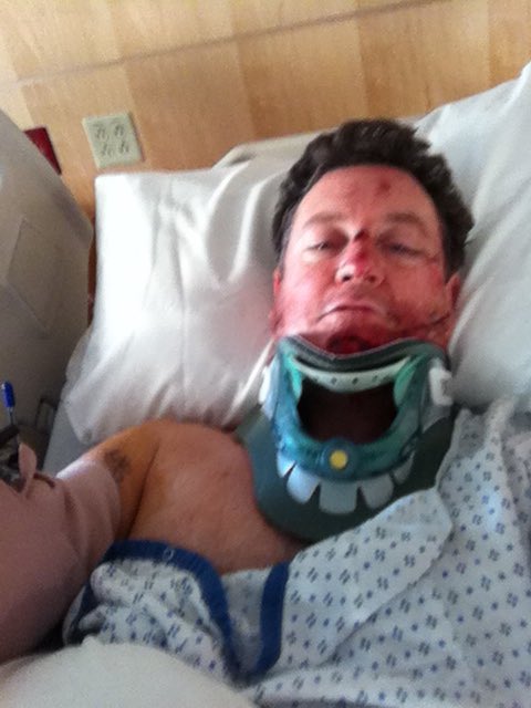 IronNEO's tweet photo. Five years ago today - tumbled off my bike #comeback18 #alaskaman #TeamIronCowboy @hopkinsanity @IronCowboyJames https://t.co/9enn947MUH